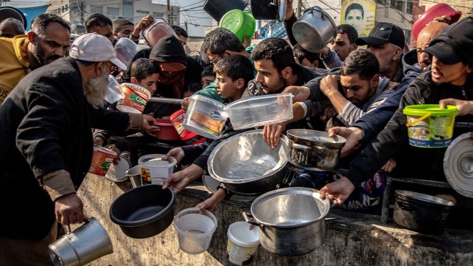 Malnourishment could lead to even more deaths among children in Gaza