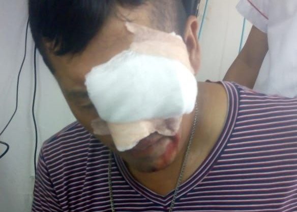 Photo of a peasant injured during police repression in Popayan